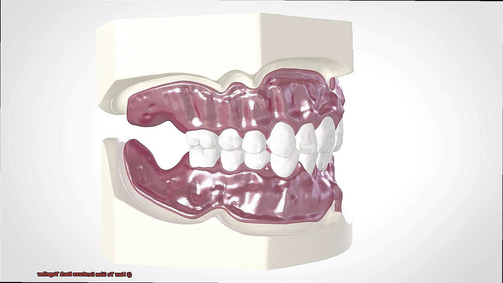 How To Glue Dentures Back Together-6