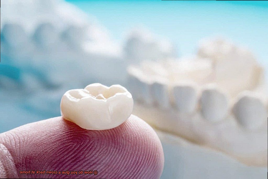 How do you glue a crown back at home? Glue Things