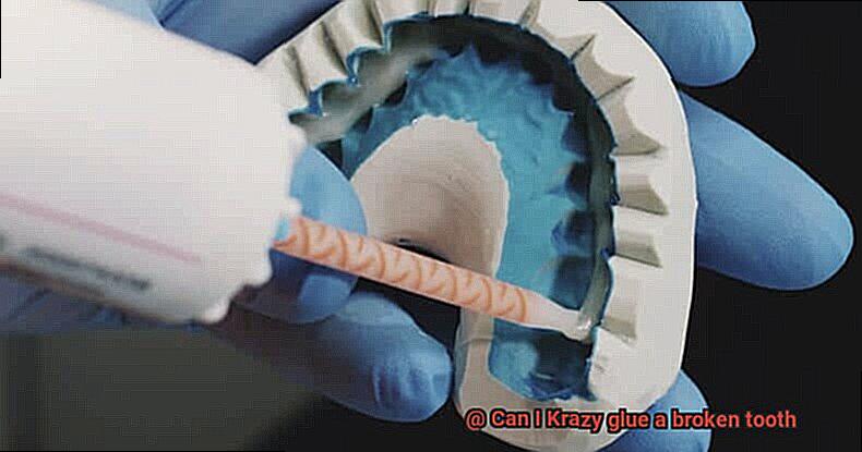 Can I Krazy glue a broken tooth-6