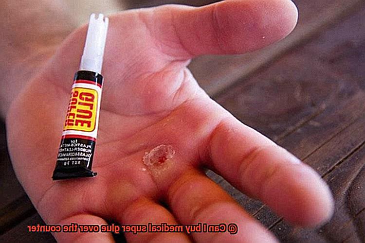 Can I buy medical super glue over the counter-6