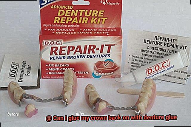 Can I glue my crown back on with denture glue-2