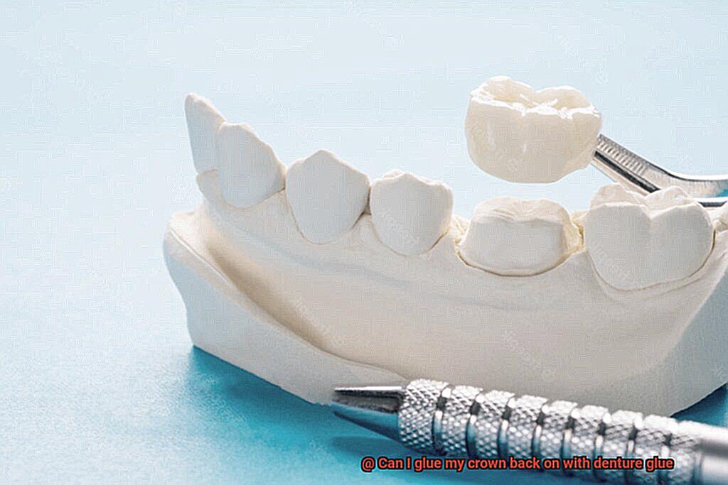 Can I glue my crown back on with denture glue-3