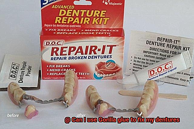 Can I use Gorilla glue to fix my dentures-5