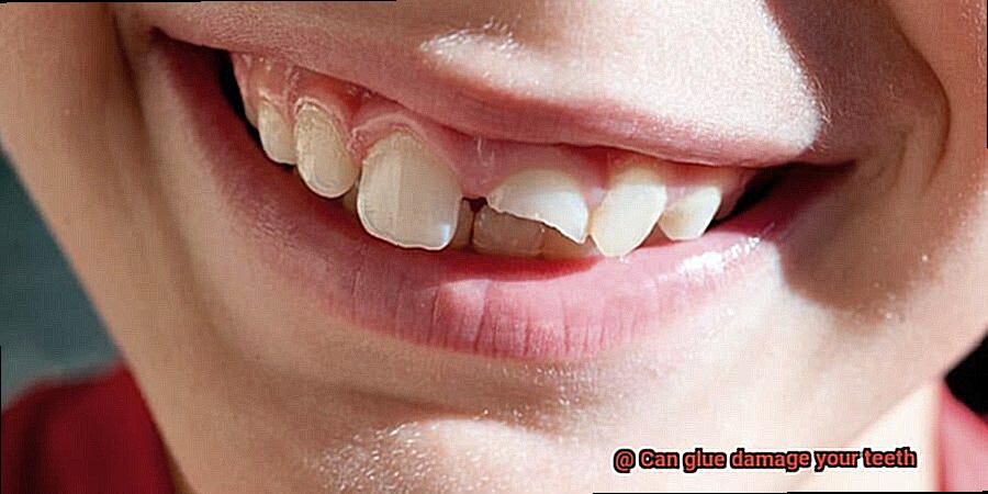 Can glue damage your teeth-2