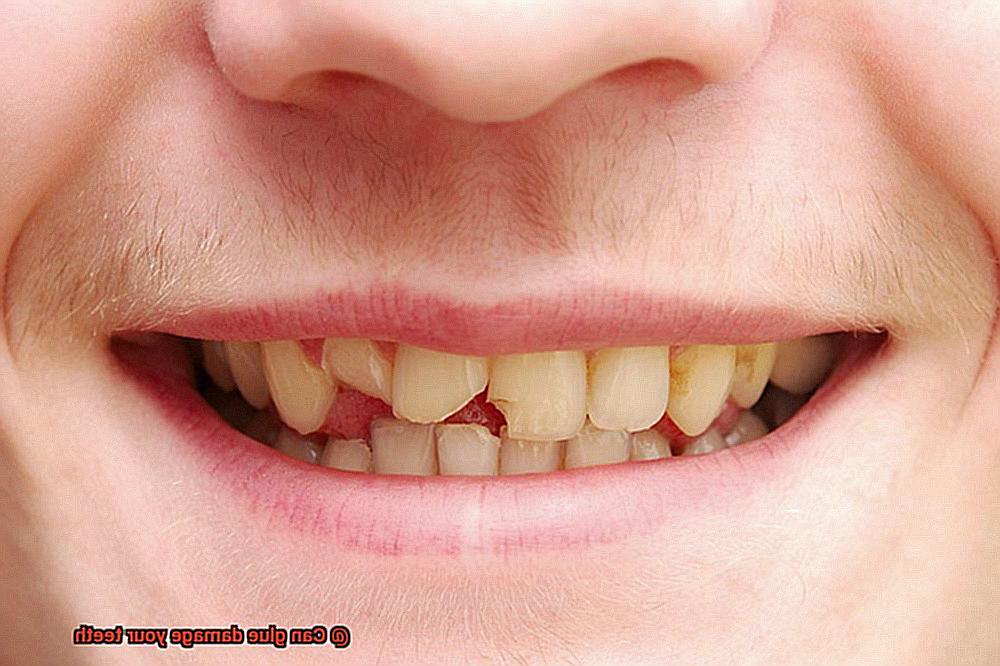 Can glue damage your teeth-7