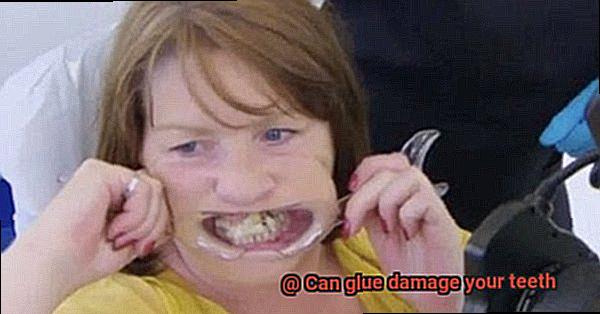 Can glue damage your teeth-9