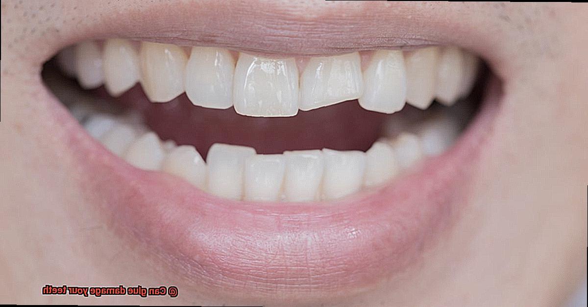 Can glue damage your teeth-5