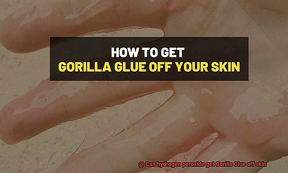 Can hydrogen peroxide get Gorilla Glue off skin-3