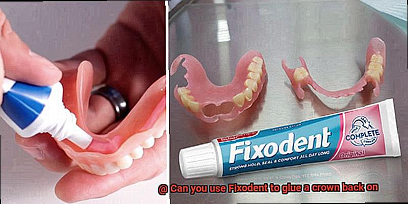 Can you use Fixodent to glue a crown back on-4