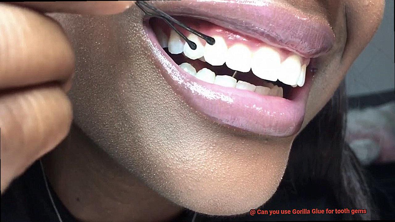 Can you use Gorilla Glue for tooth gems-2