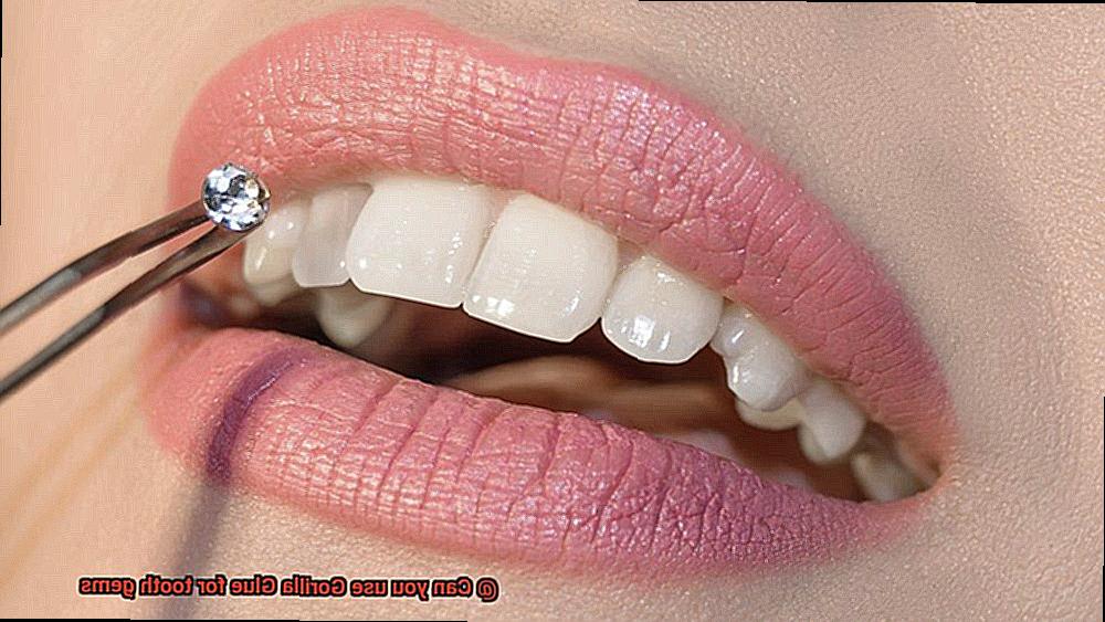 Can you use Gorilla Glue for tooth gems-7