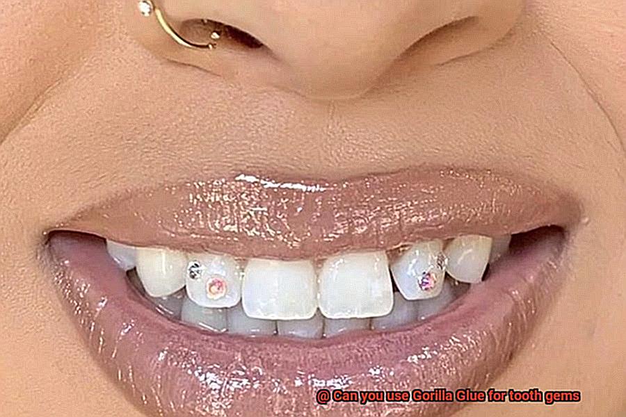 Can you use Gorilla Glue for tooth gems-8