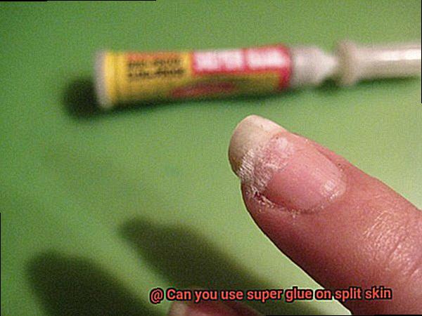 Can you use super glue on split skin-7