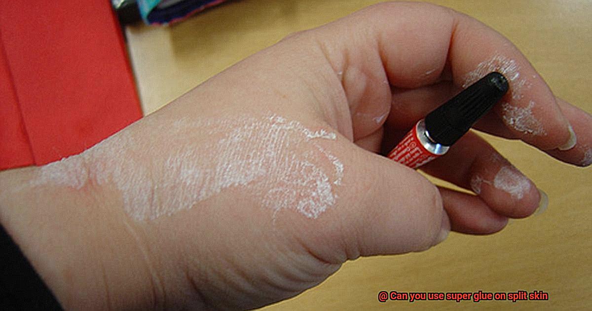 Can you use super glue on split skin-8