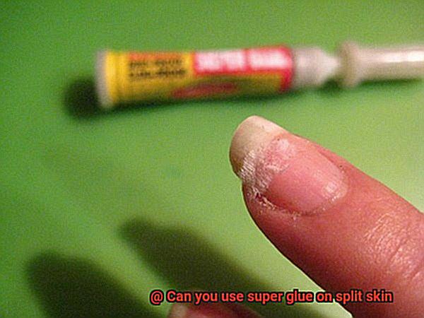 Can you use super glue on split skin-4