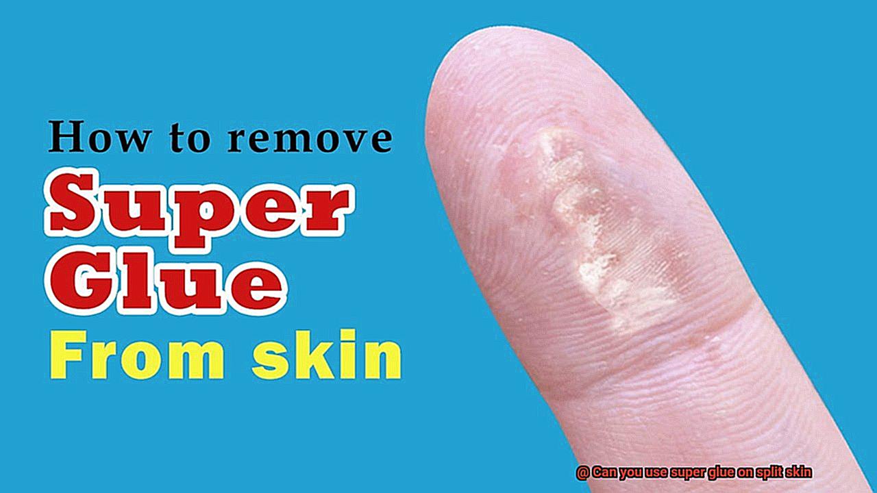 Can you use super glue on split skin-2