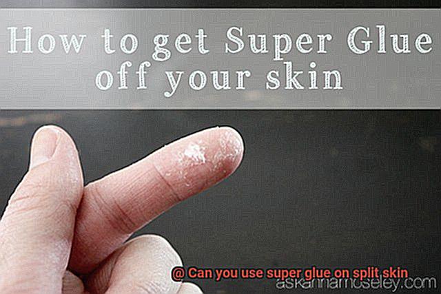 Can you use super glue on split skin-3