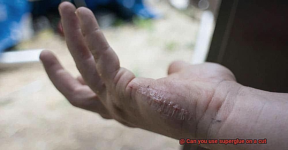 Can you use superglue on a cut-14