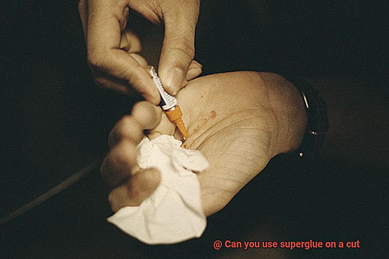 Can you use superglue on a cut-5