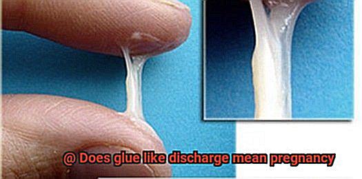 Does glue like discharge mean pregnancy-5