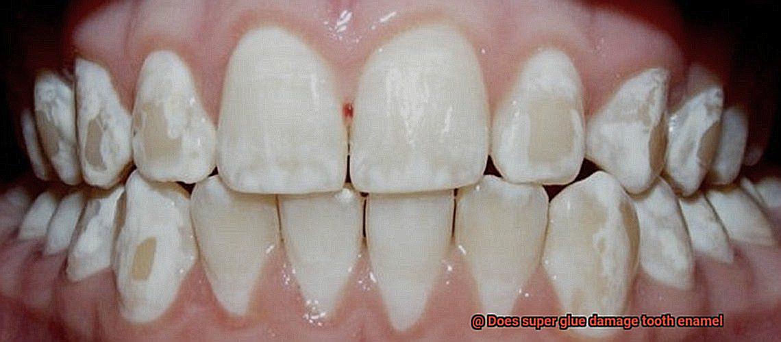 Does super glue damage tooth enamel-7