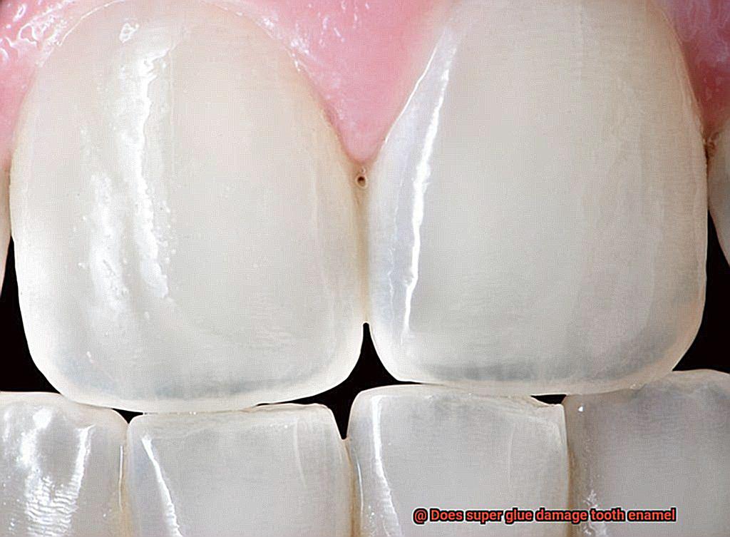 Does super glue damage tooth enamel-6