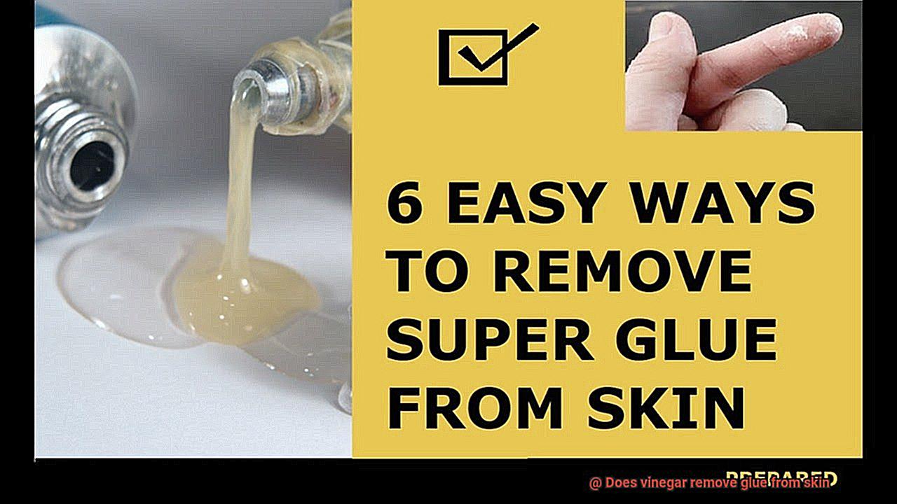 Does vinegar remove glue from skin-2