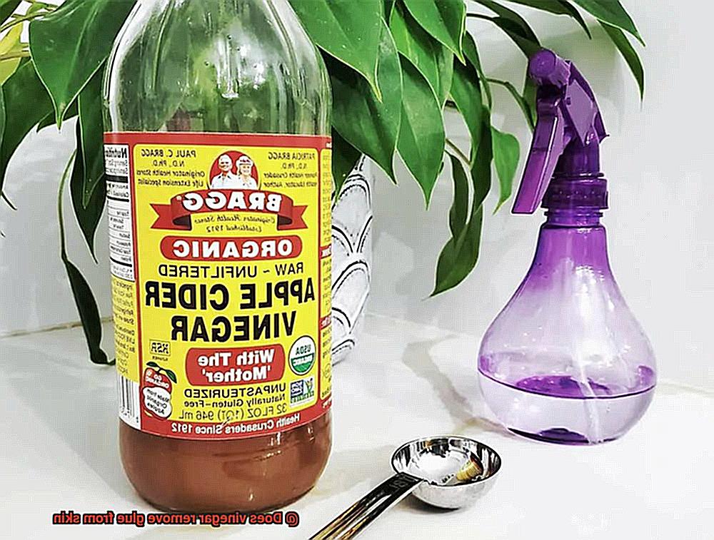 Does vinegar remove glue from skin-3