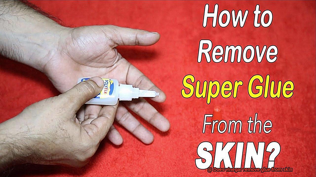 Does vinegar remove glue from skin-7