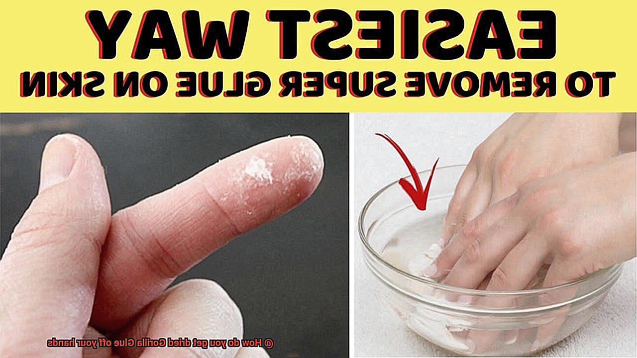How do you get dried Gorilla Glue off your hands-3