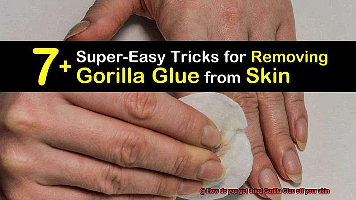 How do you get dried Gorilla Glue off your skin-2