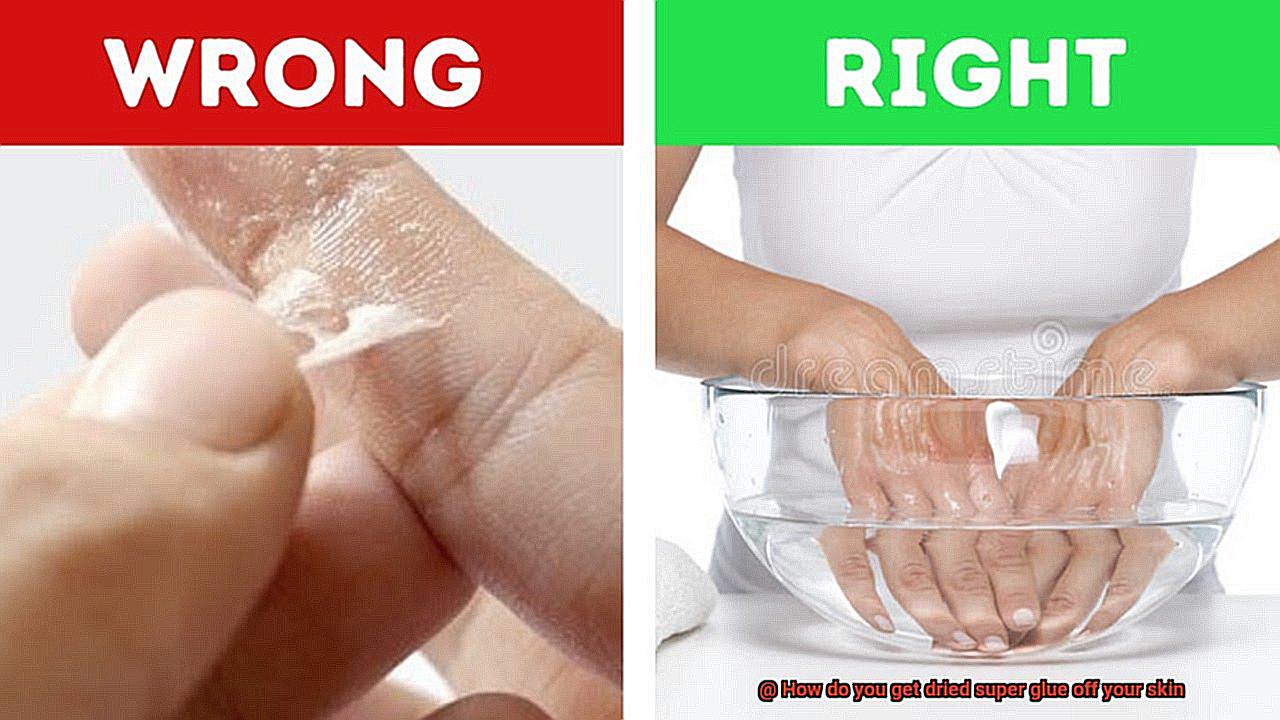 How do you get dried super glue off your skin-3