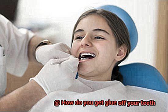 How do you get glue off your teeth-3