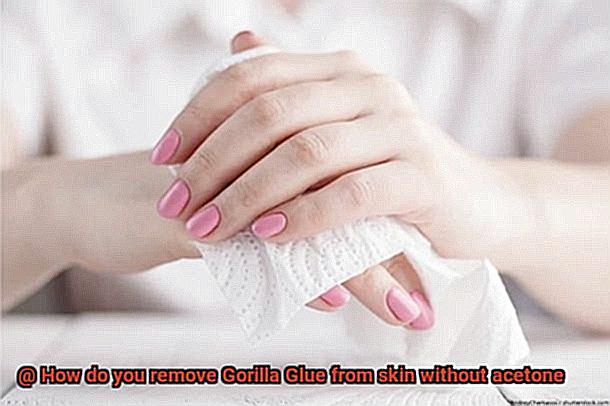 How do you remove Gorilla Glue from skin without acetone-3