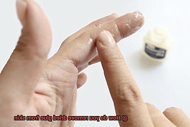 How do you remove dried glue from skin-3