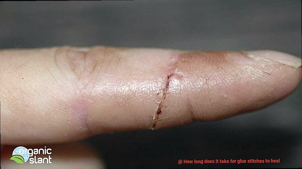 How long does it take for glue stitches to heal? Glue Things