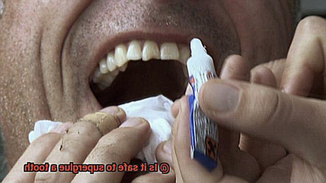 Is it safe to superglue a tooth-2