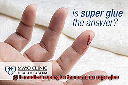 Is medical superglue the same as superglue-3