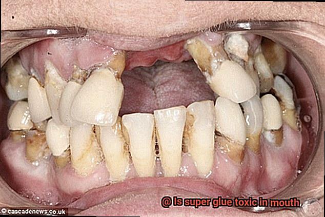 Is super glue toxic in mouth-2