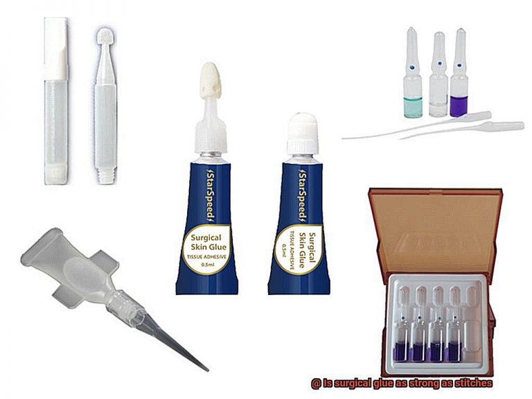 Is surgical glue as strong as stitches? Glue Things