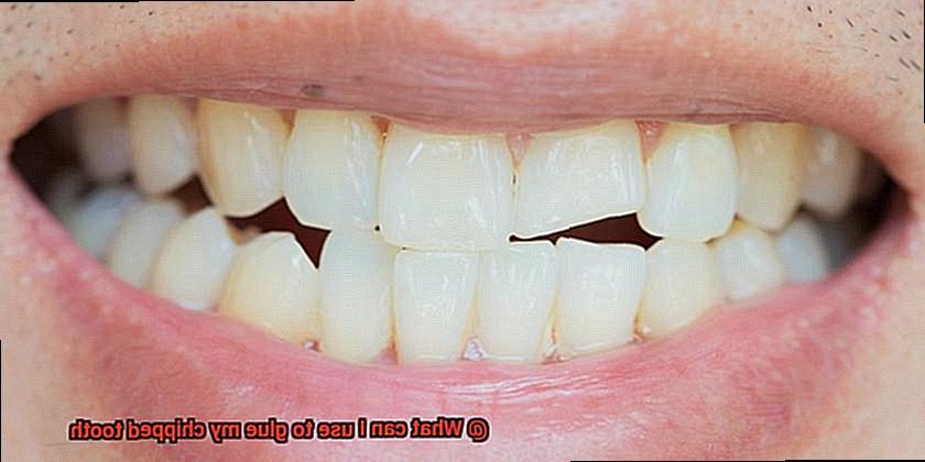 What can I use to glue my chipped tooth-4
