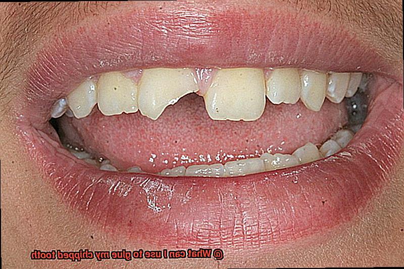 What can I use to glue my chipped tooth-5