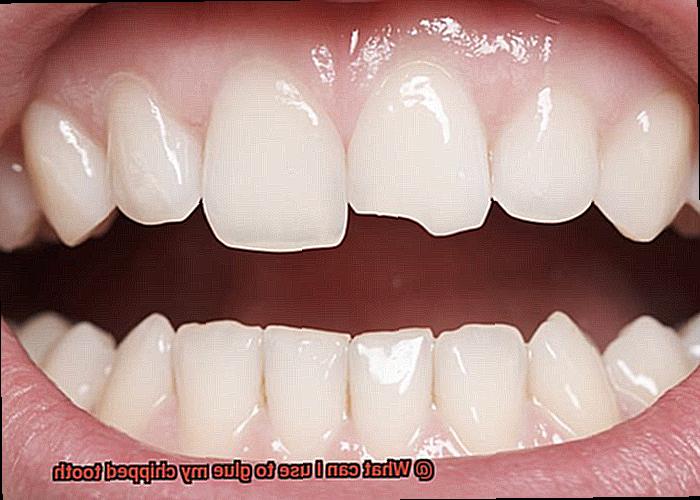 What can I use to glue my chipped tooth-6