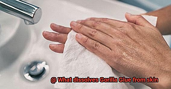 What dissolves Gorilla Glue from skin-2