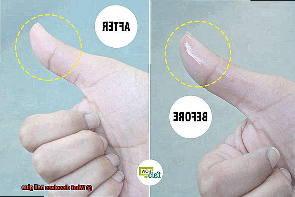 What dissolves nail glue-4