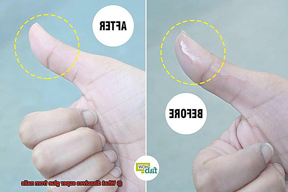 What dissolves super glue from nails-3