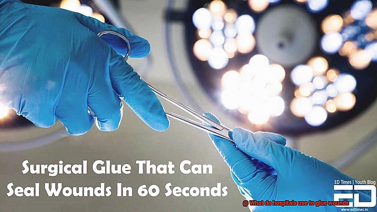 What do hospitals use to glue wounds-4