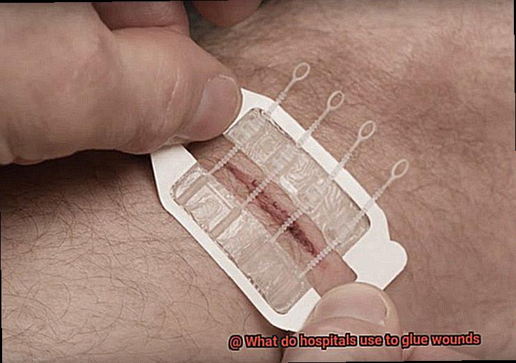 What do hospitals use to glue wounds-2