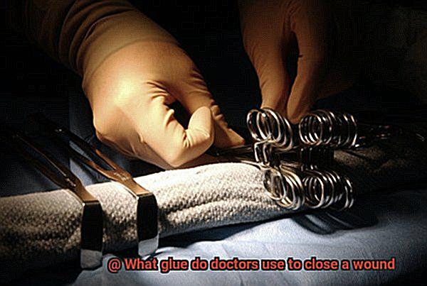 What glue do doctors use to close a wound-2