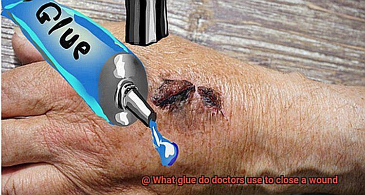 What glue do doctors use to close a wound-4